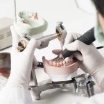 Removable Prosthodontics